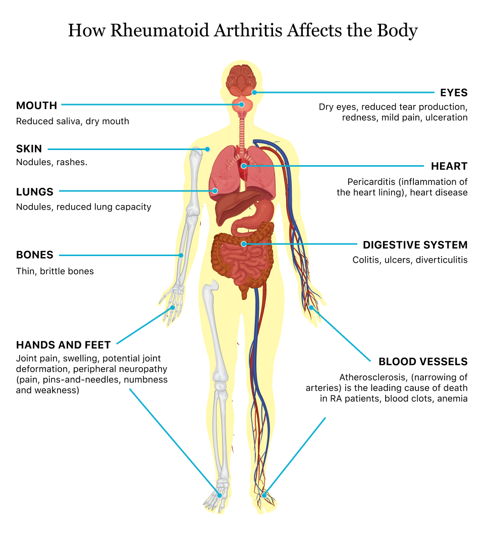 what body parts are affected by scid