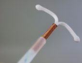 Copper IUD