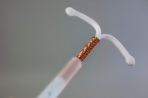 Copper IUD