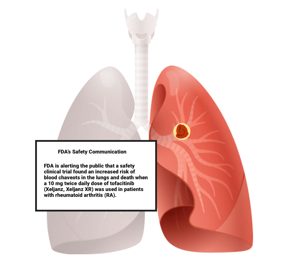 Xeljanz Side Effects Blood Clot Infection And Cancer Risks