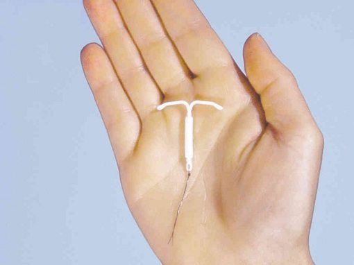 mirena IUD resting on a hand