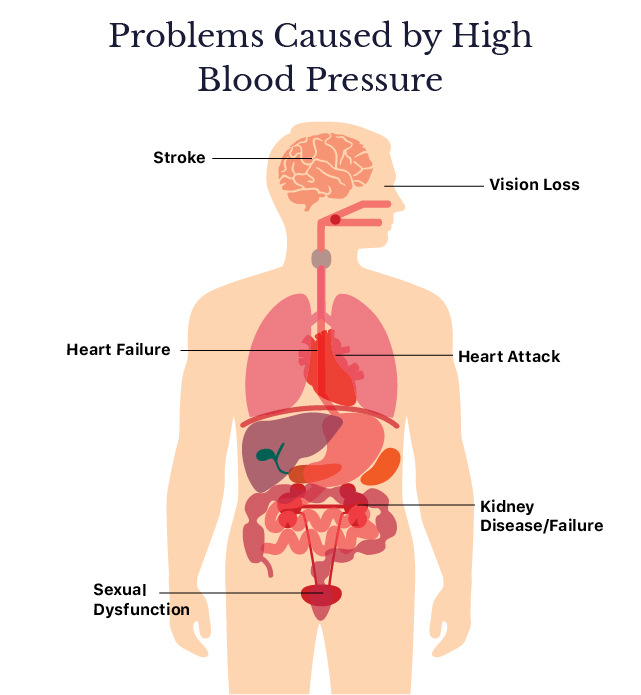 Lowering high blood pressure