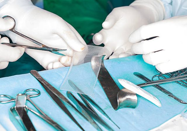 Surgical mesh being handled by surgeons