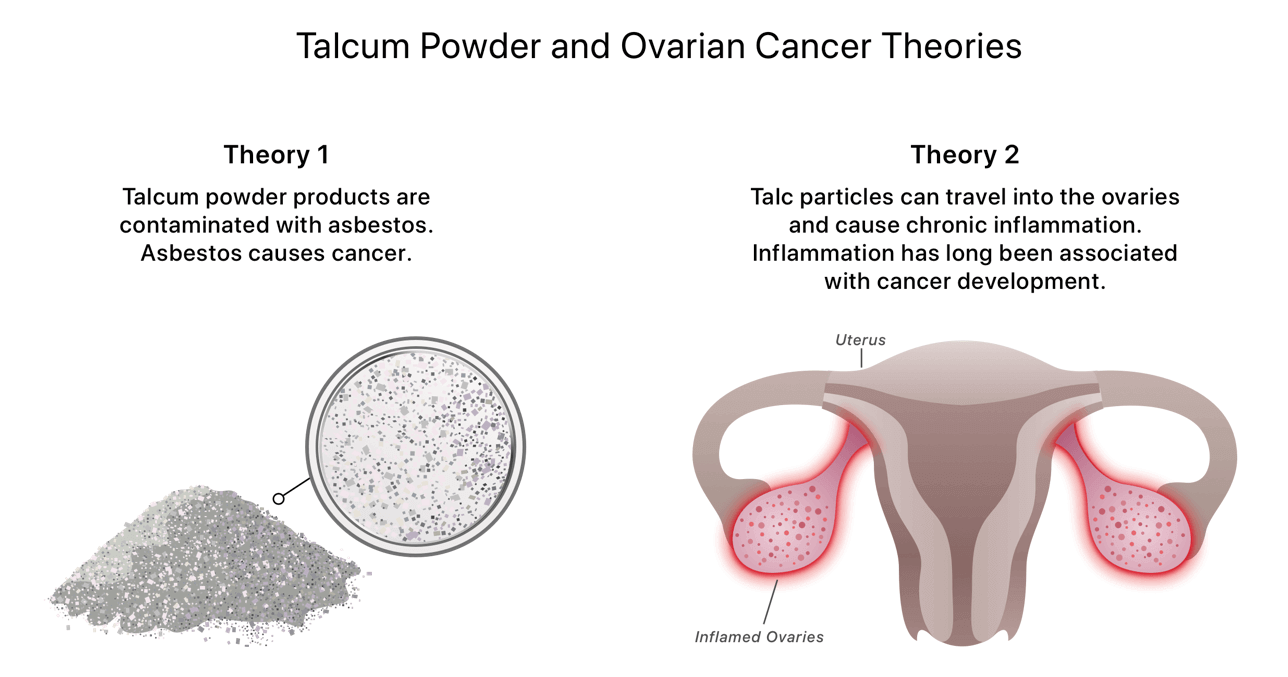 Talcum Powder Cancer Risk Does Talc Cause Cancer