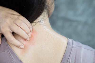 itchy rash back of neck